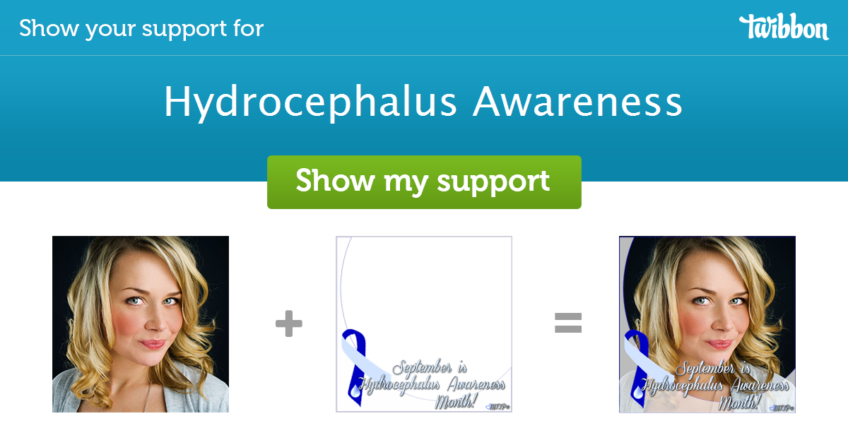 Hydrocephalus Awareness Support Campaign Twibbon 7154