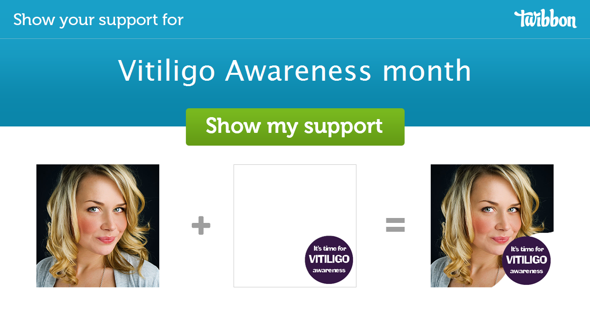 Vitiligo Awareness Month Support Campaign Twibbon 6395