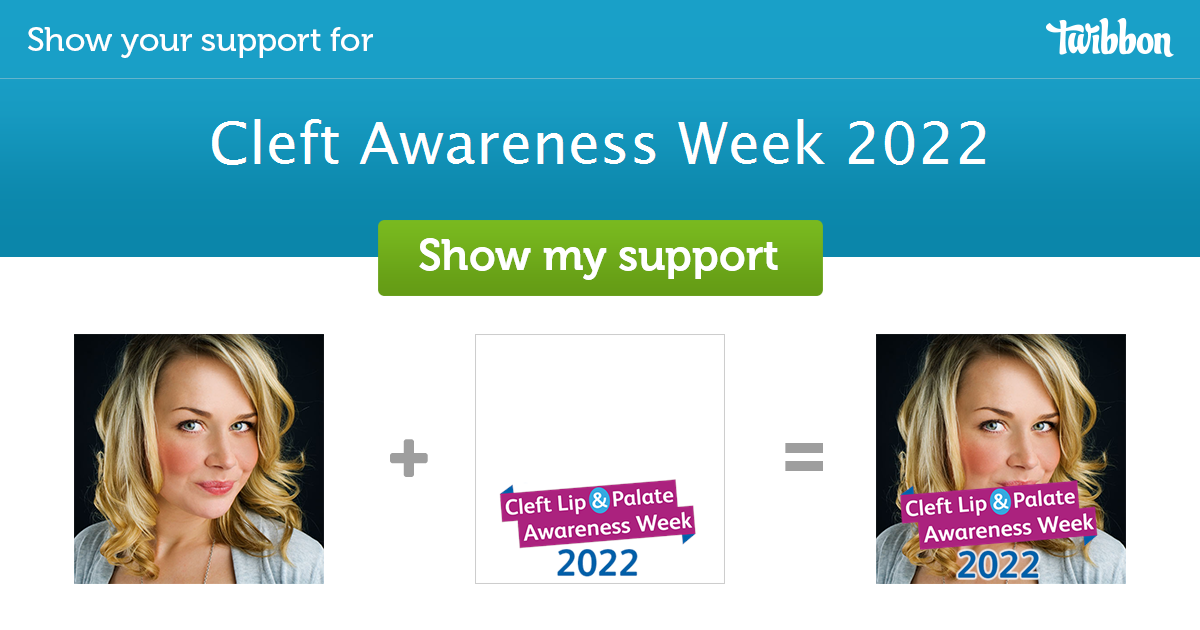 Cleft Awareness Week 2022 Support Campaign Twibbon